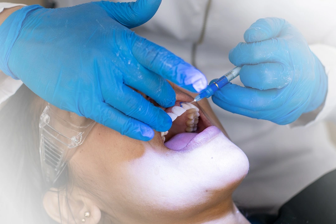 Faccette dentali Studio dentistico a Brindisi Sorridi in Puglia